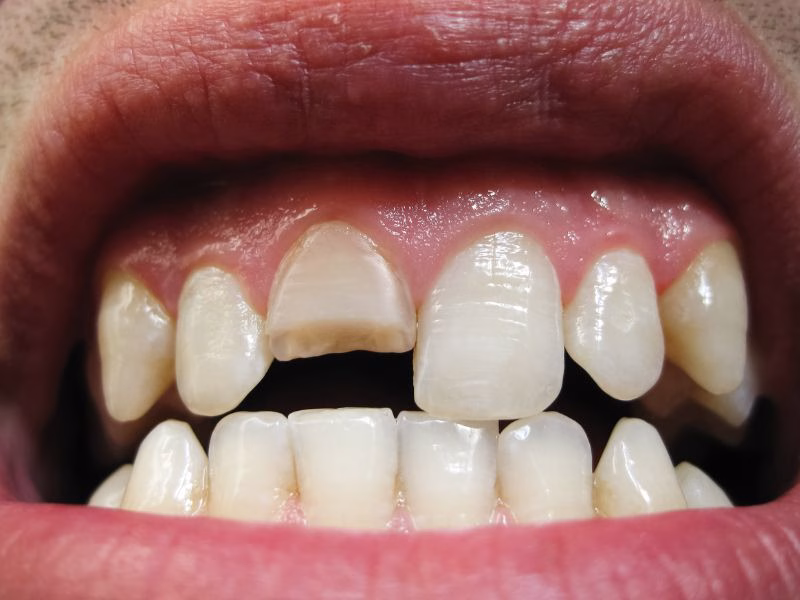 Odontología restauradora